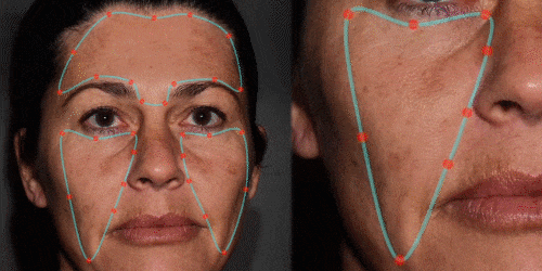 Ādas analīzes animācija