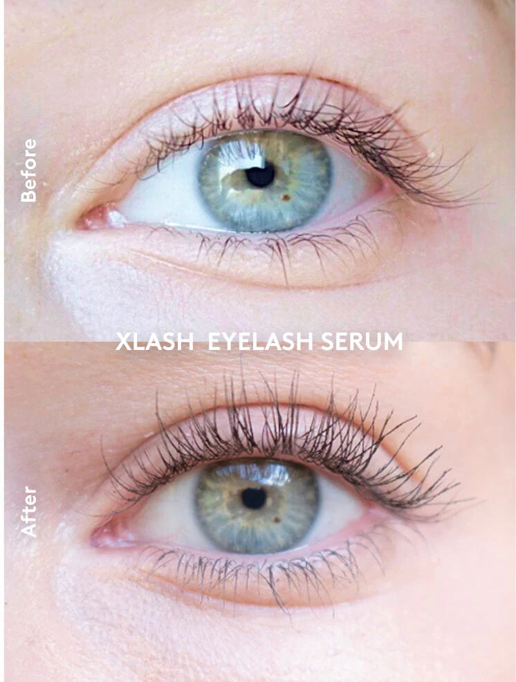 SKROPSTU SERUMS